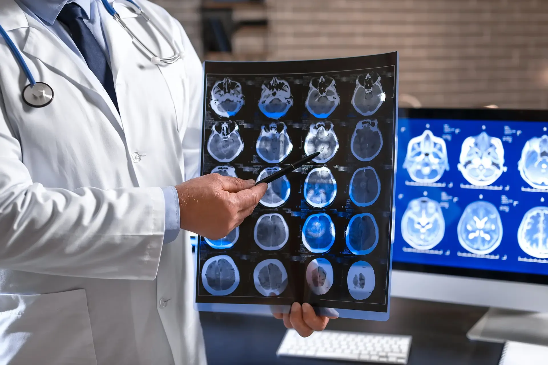 Lesiones cerebrales traumáticas Lesiones cerebrales traumáticas